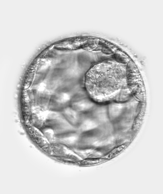 Unraveling the Mystery: Why is the Embryo Not Growing in IVF
