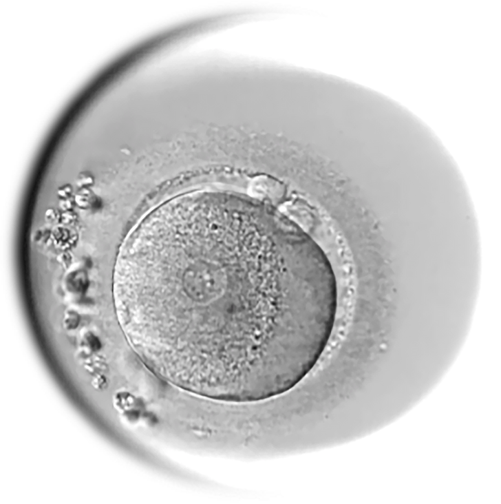 An inseminated egg classified as 1PN (monopronuclear).